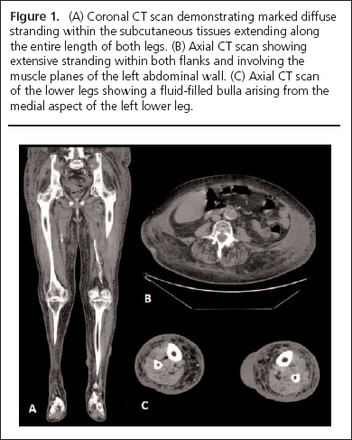 Biscoe-figure1