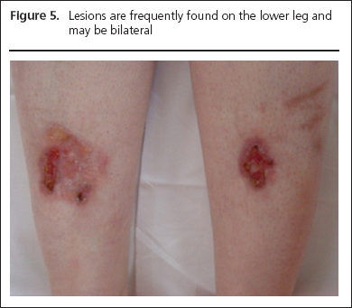 George Part 1, Figure 5